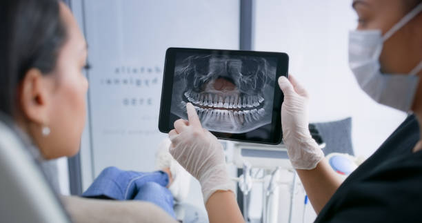 Licensed Teeth Whitening service in Lamar, TX - Smile Center Dentistry